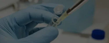 Clinical stem-cell processing image from Anadolu Medical Center's adult bone marrow transplant center